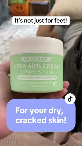 Trying out @Grocerism’s urea cream on my fiance’s rough, dry knees! I think it works! We are going to keep using it for a few more days to see if it completely gets rid of the dryness. #grocerism #grocerismureacream #ureacream #footcream #dryskin #dryskintips #foottok #urea #tiktokshopfinds #tiktokshopping 