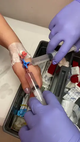 iv cannulation💉 Two side #medicalastudent_ #medical_ #nurses_ #doctor_ #shortsvideo_ 