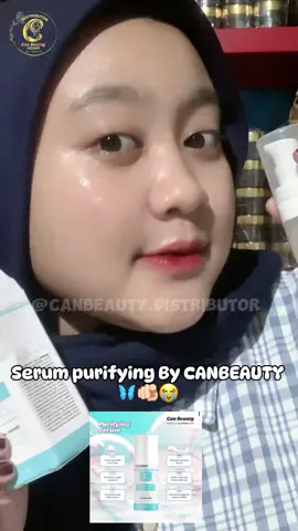 Acne Fighter kumpul sini yuk kenalan sama satu serum dari CANBEAUTY💙✨🦋 PURIFYING SERUM CANBEAUTY memiliki kandungan yang baik untuk mengatasi dan mencegah timbulnya jerawat buat kulit sensitif bisa banget dong😍🫵🏻🔥✨#JelajahLiburan #canbeautyofficial #canbeautydistributor #canbeautysidoarjo #canbeautyoffical #canbeautyviral #canbeautyjombang #canbeautykediri #canbeautybpom #canbeautysedati #canbeautysurabaya #canbeautyacnedanwhitening #masukberandafyp #skincaresehat #putihsehatcantik #serumacne #serumcanbeauty #serumpurifyingcanbeauty #purifyingserumcanbeauty #purifyingserumcanbeauty #serumthebest #serumbestseller #serumacne #serumpurifying #canbeautypowerup 