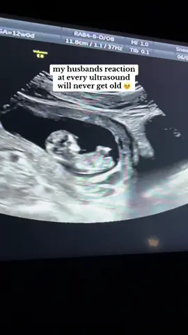 sometimes I forget this is his first time experiencing this too 🥹🫶🏻 #husband #wife #marriedlife #pregnancy #14weekspregnant #firsttimemom #firsttimeparents 