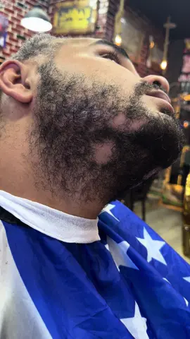 ‏علاج الثعلبه في اللحية في صالون ابوالسيد#الثعلبه_الشعر ##جلسه_الثعلبه #ابو_السيد💈🔥 #ابو_السيد_ملك_السعادة #free #الثعلبه #الثعلبه #يلا_بينا_نروح_عند_ابوالسيد 