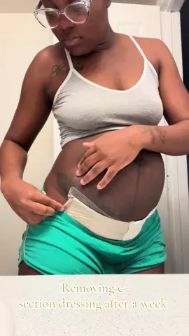 #fypシ゚viral #csectionrecovery #postpartum 