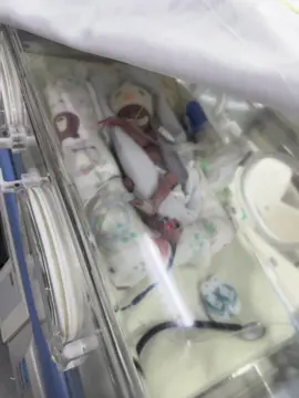 Fiquei entubado por 25 dias. Mamãe ficava comigo das 09h as 21h todos os dias! Era o horário permitido na UTIN. Papai vinha me ver todos os dias !! Logo que nasci precisei fazer transfusão sanguínea. #fy #fyp #prematurebaby #utineonatal #baby 