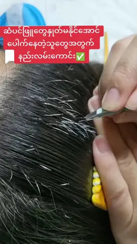 ၁လနဲ့ဆံပင်ဖြူပြန်နက်စေမဲ့နည်း#ဆံပင်ဖြူပြန်နက်စေတဲ့နည်းလမ်း #ဆံပင်ပြသနာရှိသူတိုင်းကြည့်ပေးပါ #haircare #fyppo #tiktokuni #thankyou #foryoupage #foryourpage #foryou #VoiceEffects 