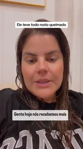 Deus tem nos dado crianças muito especiais, que passaram por uma dor emocional e física profunda. E nós vamos dar o nosso melhor pra que haja cura na vida deles… E Hoje recebemos mais um príncipe na Casa do Amor @casa.do.amor  Bernardo Tito, 12 anos. É um caso bem delicado, e eu não pude dizer não!! Ele é de Malanje, província de Angola. Ele tem epilepsia e em um dos episódios de crise, caiu com o rosto dentro da fogueira.🔥 onde cozinham a comida. Esteve internado por 6 meses…. E sem visitas dos pais, apenas o avô, um Velhinho que vinha visitar ele raramente. Foi pedido ajuda pra o Bernardo pra que ele possa ter um lugar pra ficar e tbm ajudar com tratamentos… Que juntos possamos ajudar o Bernardo com tudo que ele precisa. Cirurgia plástica no rosto, tratamento oftalmológico, fisioterapia. Que Deus nos dê sabedoria pra cuidar de todas as crianças que Ele têm confiado a nós ❤️❤️ #amor #fazerobem