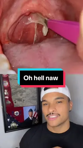 I wouod be gagging if someone had tweezers in my throat lol #mrpopalot 