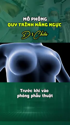 Mô phỏng quy trình nâng ngực#bacsichieu #nangnguc #pttm #drchieu 