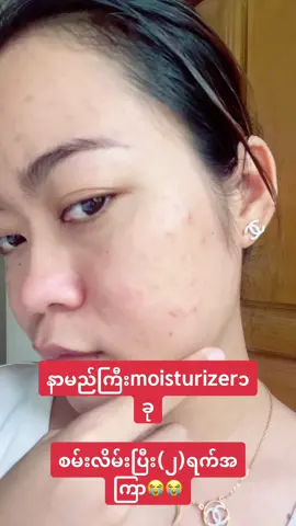 ပြချင်ဦးလေ လက်တွေ့ 😖😩😩 #မထိုက် #စတီးရွိုက်ဝက်ခြံ #ဝက်ခြံ #skinbarrier #ပျက်စီး #moisturizer #😭😭😭 