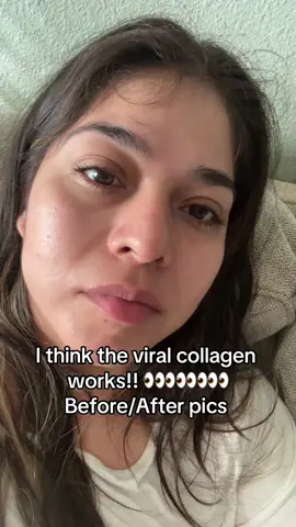 I think the viral collagen peptides are working!! #collagenviral #collagen #skincare #fypシ゚viral 