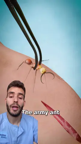 Curioso @Zack D. Films #salud #invento #SabiasQue #enfermereria #novedad 