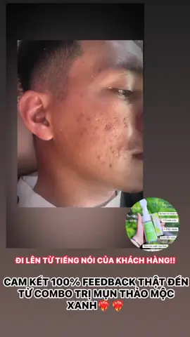 thảo mộc xanh mãi đỉnh❤️‍🔥❤️‍🔥 #xuhuong #thaomocxanh #feedback 