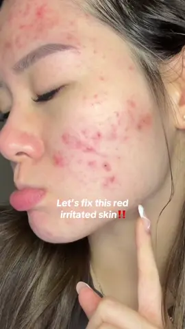 Skip the hassle AAAND the danger of making ur own rice mask at home!  Just leave it all to @beautyofjoseon.id cuz trust me, ur skin will be in GOOD HANDS ‼️✨ #ricemask #beautyofjoseon #glassskin #glowskin #koreanskincare #riceskincare #acne #acneproneskin #redness 