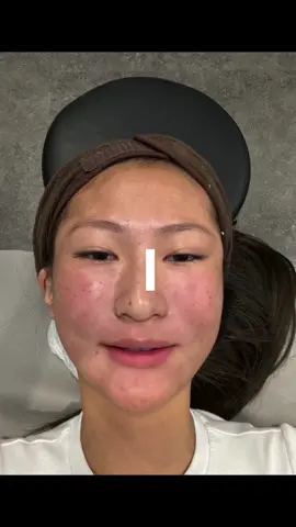 The start of my next glow up journey… @LV Plastic Surgery Aesthetics 