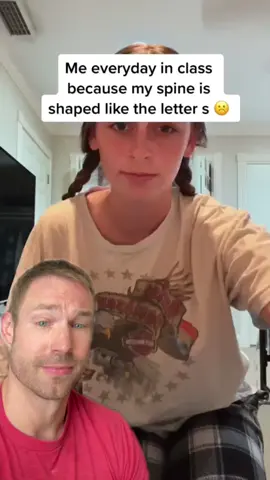 How to help back pain from scoliosis! #stitch @Abby 😋 & exercises from @thescolicoach #greenscreenvideo #greenscreen 