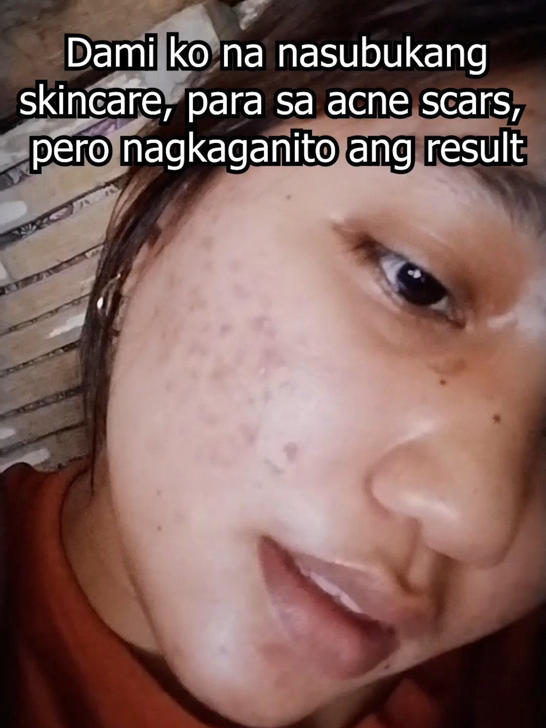 Boost your confidence with a Derma Roller! 🤩 #DermaRollerYourSkin #DermaXRoller #SkinDRPlus