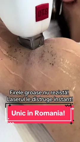 #viral #epilaredefinitiva #happyclient #fy #fypシ #girlpower #laserhairemoval #timisoara #sibiu #arad #epilevolution #epilaredefinitivaculaser @Ioana #capcut #teamwork 