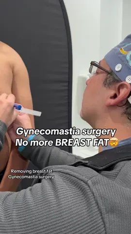 Removing breast fat for men: Gynecomastia surgery🤯🙌🏼 #before #gynecomastia #breastfat #men #patients #transformation #surgery #cosmeticsurgeon #viral #fypage #cosmetic #surgerytiktok #looseskin #plasticsurgeonsoftiktok 