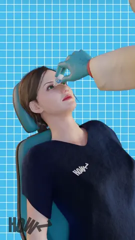 How LASIK Surgey Works #surgery #surgeon #doctor #3danimation #how #learn #reels #shorts