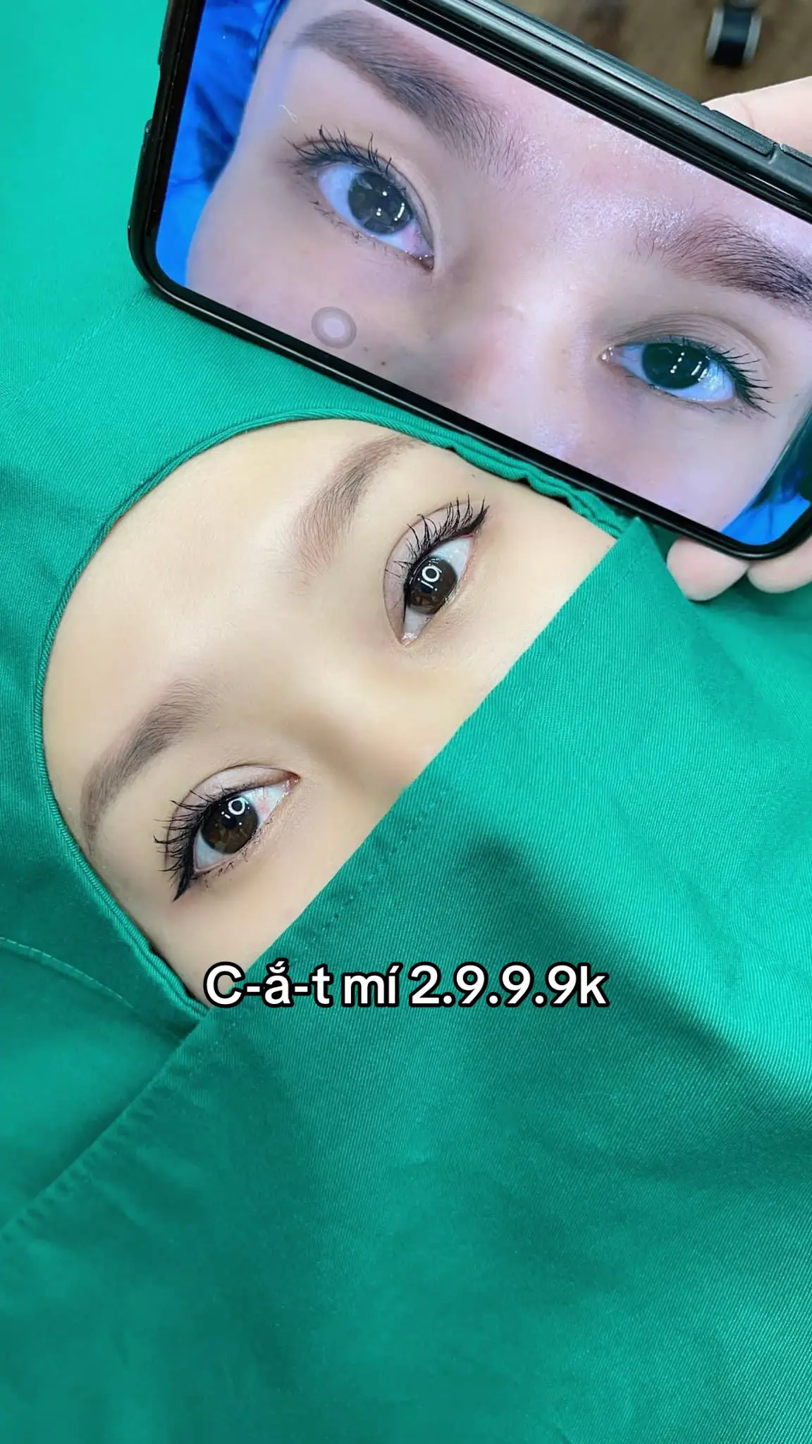 #filler #botox  #lamdep 