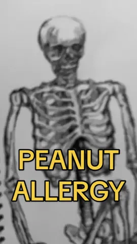 Bro’s DEFINITELY overreacting 🙄 🤣 🥜 #peanut #allergies #allergy #peanutallergy #meme #memes #fun #funny #comedy #dankmeme #dankmemes #memeanimation #animated #animatedmeme #animation #animateddoodle #animatedonpaper #paper #animatic #drawing #drawings  #art #artist #doodle #doodleart #doodles #pencil #sketch #sketches #sketchbook #short #shorts #shortvideo #shortvideo #tiktok #challenge  #fyp #stopmotion #friend #friends #Relationship 