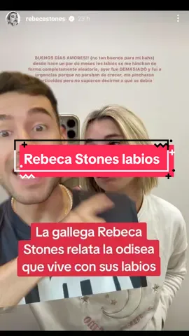 Labios de Rebeca Stones #RebecaStones #Galicia #greenscreen 