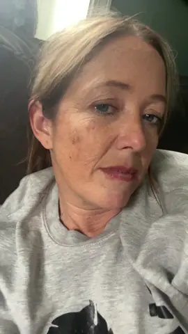 PSA #melanomaawareness #skincancer 