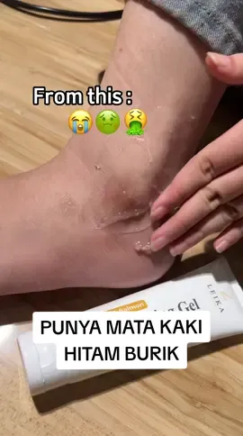 Sebelum kenal DNA salmon Exfoliating Gel mata kaki hitam burik banget 😣 eh sekarang jauh lebih cerah #leikaskincare #WIBGAJIAN #dnasalmonexfoliatinggel #matakakihitam #eksfoliasi 