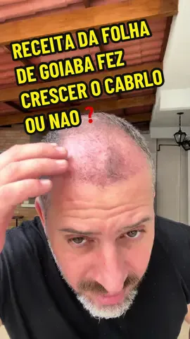 RECEITA DA FOLHA DE GOIABA CRESCEU OU NSO O CABELO👨🏻‍🦰👳🏼‍♂️👩🏽 Segue compartilha ✅ #cabelo #goiaba #careca #cabeludo #salao #estetica #fios #quedadecabelo 