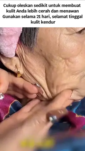 Ningkatake kekencangan kulit kanthi 5%, nambah kendur, lan nyuda kerutan kulit lan garis-garis halus wis tekan 100.000+