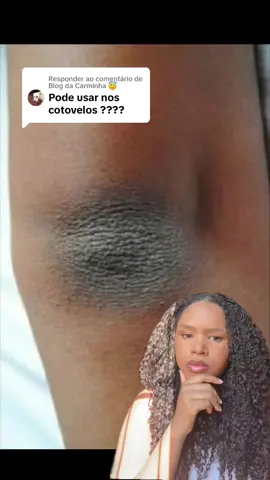 Respondendo a @Blog da Carminha 😇  Como clarear qualquer regiao do corpo. @Dove Brasil  #manchas #manchasmelasma #melasma #cotovelosescuros #joelhosescuros #niacinamida 