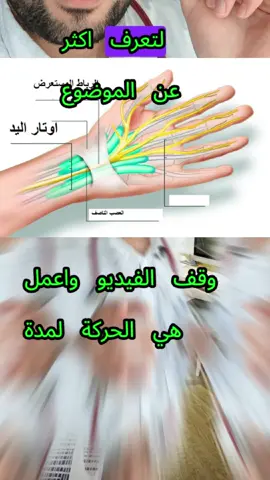 متلازمة النفق الرسغي, افحص نفسك #متلازمة_النفق_الرسغي #carpaltunnel #karpaltunnelsyndrom #carpaltunnelsyndrome #متلازمة