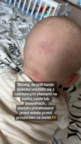 A wasze maluchy zostały pocałowane przez anioła? #angel #baby #dziecko #niemowle #syn 