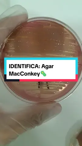 Sabrás que Bacteria será la que creció en este agar MacConkey? #biologia #biology #salud #health #microbiologia #microbiology #cienciaentiktok #cienciadivertida #laboratory #laboratorio #Science #ciencia #medicine #medicina #CapCut 