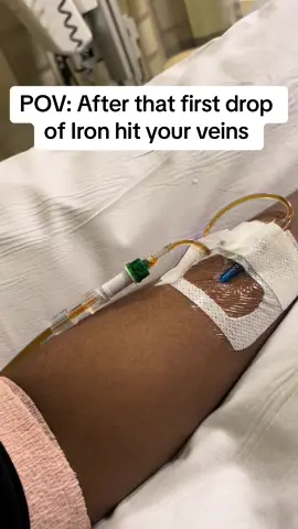 Life of a Severely Iron Deficient Anemic 😮‍💨 Give me all the Iron 🦾 #ironinfusion #irondeficiency #anemia #foryou 
