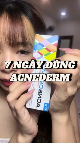 7 ngày dùng acnederm
