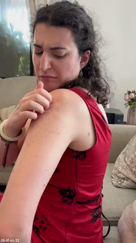 He intentado de todo, pero la piel de gallina no mejora. Es realmente desesperante. ¿Alguien más ha pasado por esto?#clearzal #keratosispilaris #kp
