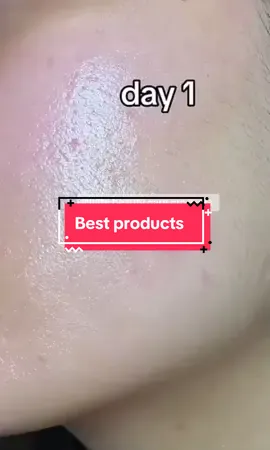 Best product White beauty care products 💯👍