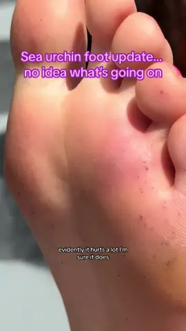 @Dr Karan Raj medical situation need help thanks @tiktokforlife 🫣🫣 #seaurchin #seaurchinspines #immunehealth #immunesystembooster #immunesystem #toxin #detox #medicaltiktok #medicalhumor 