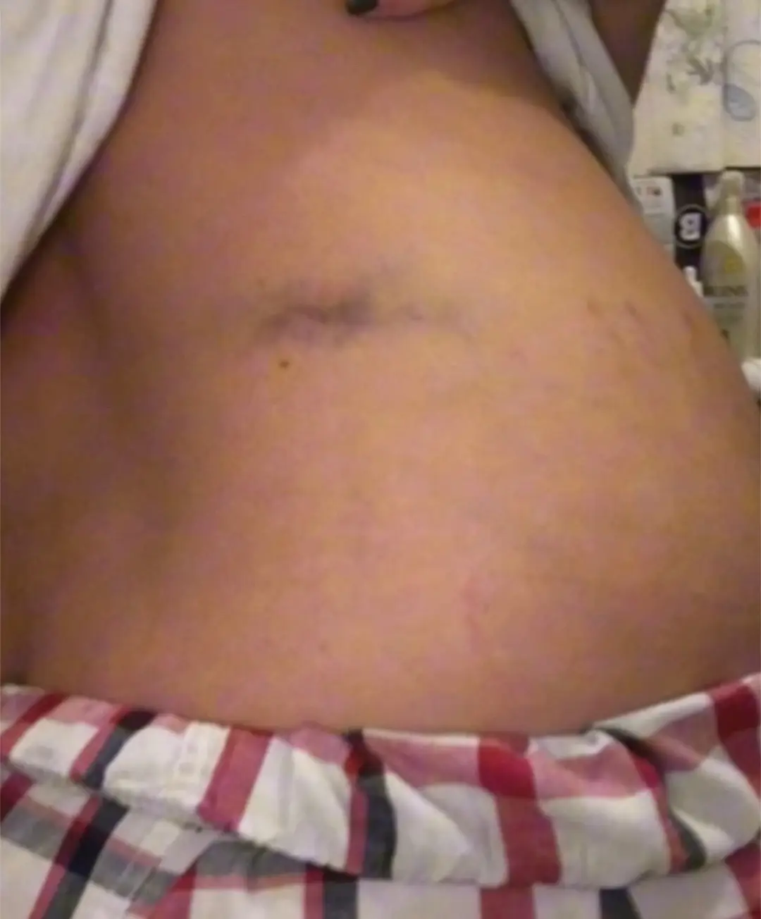 4 years since i was given a 2nd chance that most dont get! Looking back i didnt know why but now I see why God told me no mam not today! No man/woman is worth you loosing your life! My poker face was so good that noone even knew something was wrong with me except 2 people because I told them. It only took me 3 weeks to crash to the ground and i can say that was the darkest time of my life! Loosing the same man who told me to unalive myself i had to fight my demon and going back to that same cycle having to take 5 bars at a time to survive. But I chose to be stronger then i ever have before and here i am today💖 #grateful#secondchanceatlife#4yearsclean#od#traumabond#toxic#toxicrelationship#fentanylkills 