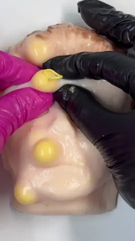 Micharl Myers had his skin care treatment   Satisfyilng?????#asmrsounds #asmr #viral #fypシ #relax #skincare #mouthsounds #satisfying #tingles #asmrtriggers #mochipimplepopping #pimplepoppin #acnetreatment #asmrtiktoks #asmr_tingles #michaelmyers 