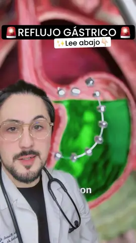 ¿Sabías que? @doctormickas ✨🔥 En el ERGE (Enfermedad por reflujo Gastro Esofsgico) uno de los tratamientos que mas ha ayudado a los pacientes es el anillo que permite el paso de alimentos pero evita el reflujo🫣 ¿Sabías esto, que opinas? 👀 #doctormickas #longervideos 