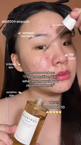 if you have damaged skin barrier, redness, PIE scars & irritated skin. this skin1004 madagascar centella asiatica ampoule is definitely my favorite! the best ingredients for soothing irritated and sensitive skin! 🫶🏼✨⭐️⭐️⭐️⭐️⭐️ #skin1004 #skin1004ampoule #centellaasiatica #skinbarrierrepair #sensitiveskin #koreanskincare 