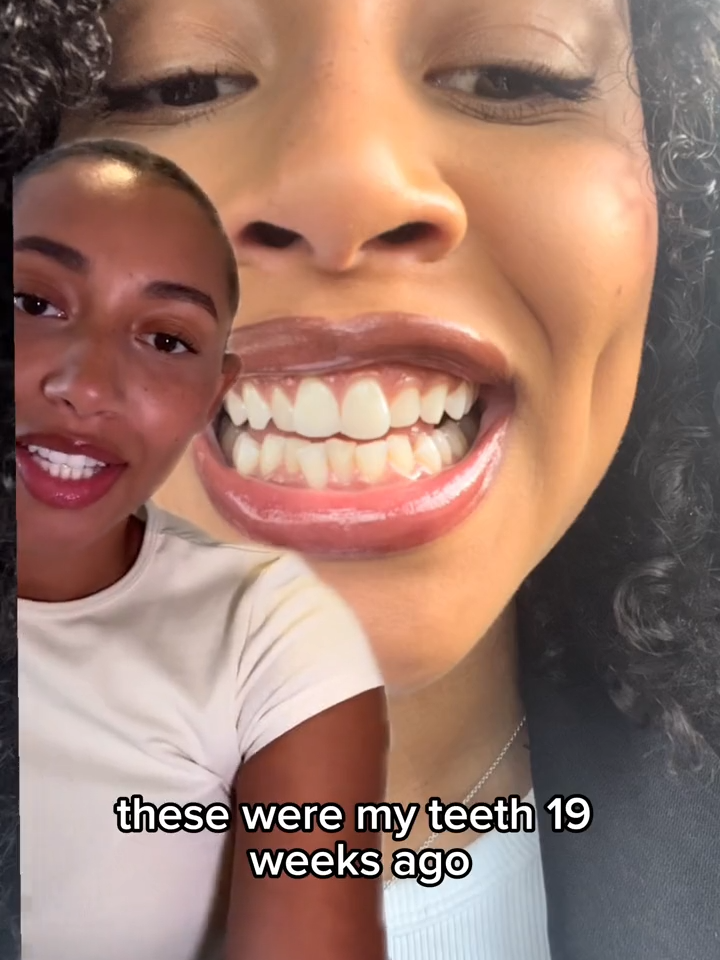 UK's Highest Rated Clear Aligners 🌟