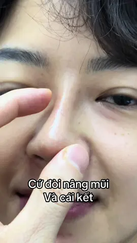 #nangmui #xuhuong #bsphamhao #suamuihong #gheptrungbi #lamdep 