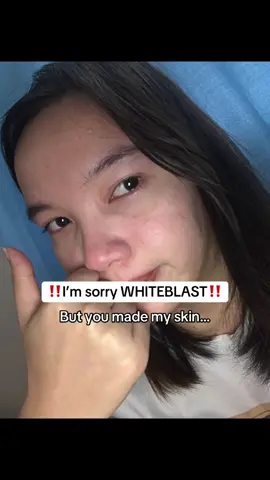 6mos+ of using White blast soap🥹Trust the process lang talaga ! #whitening #whiteblastbleachingsoap #whiteblast #whiteningsoap #soaprecommendations #foryoupage 