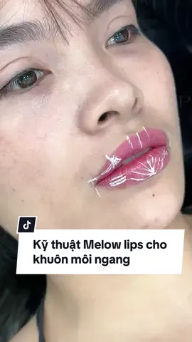 Thiết kế dáng môi cho khuôn môi ngang bè, không rõ form môi #vantranfiller #xuhuong #filler #botox #LearnOnTikTok 
