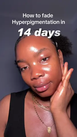 Want an even skin tone ?This is the Anua TXA dark spot correcting serum that contains this active ingredients like  Niacinamide, Tranexamic Acid, and Arbutin to target post-acne scars, hyperpigmentation,spots  Link of this product in my bio @anua_kr @anua.skincare_us #anua #darkspots #skincare #affordableskincare #acnescars #niacinamide #koreanskincare #txaserum #skincaremusthaves #skincarerecommendations #review #skincareproducts #skincaretips #beauty #hyperpigmentationtreatment #hyperpigmentation 