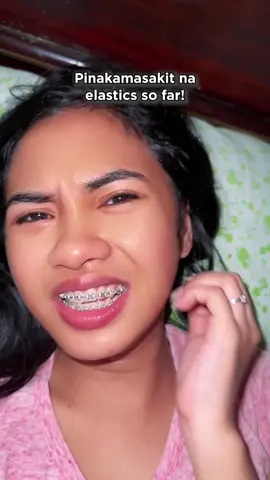 Iyak siya eh😭Hoy legit yung higpit at sakit anak ng tipaklong!!!🤣 #Braces #rabbit #fox #penguin #morningpain #bracespain #midline #tads #tadsprice #elastic  #bracesupdate #bracestips #braceselastic #lavender #alignment #BracesAdjustment  #14th  #Bracesjourney #Missingteeth  #UDC #udclinic #bracesrubberbands  #rubbercolor #fyp #camillevelasco #14thadjustment #powerchain #fbreels #closingspace #white #whiterubber #tealrubber #ligaturewire #ligature #fullchain #rubbersuggestion #teethtok #gummysmile #cantedsmile #adjustment #afteradjustment #tadsbraces #dentist #specialist #orthodontist #LearnOnTikTok 