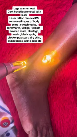#viral#kampala_uganda🇺🇬🇺🇬🤝 