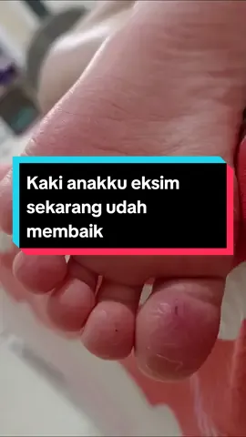 Oh iyaaa, lotion ini bisa untuk kulit wajah juga loh  Belinya di keranjang kuning aku yaa #produkviral #lotion #eksim  #pelembabkulitkering #pejuangeksim 